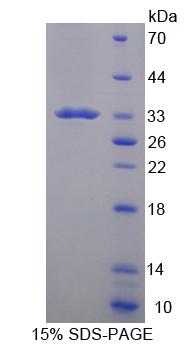 SDS-PAGE
